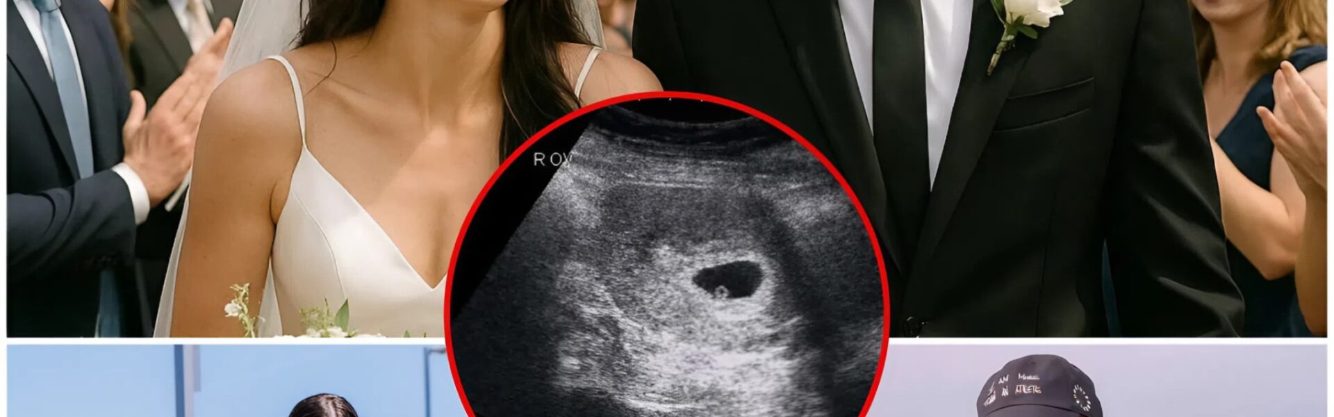 Caitlin Clark Shares Joyous News: Expecting Twins at Five Weeks