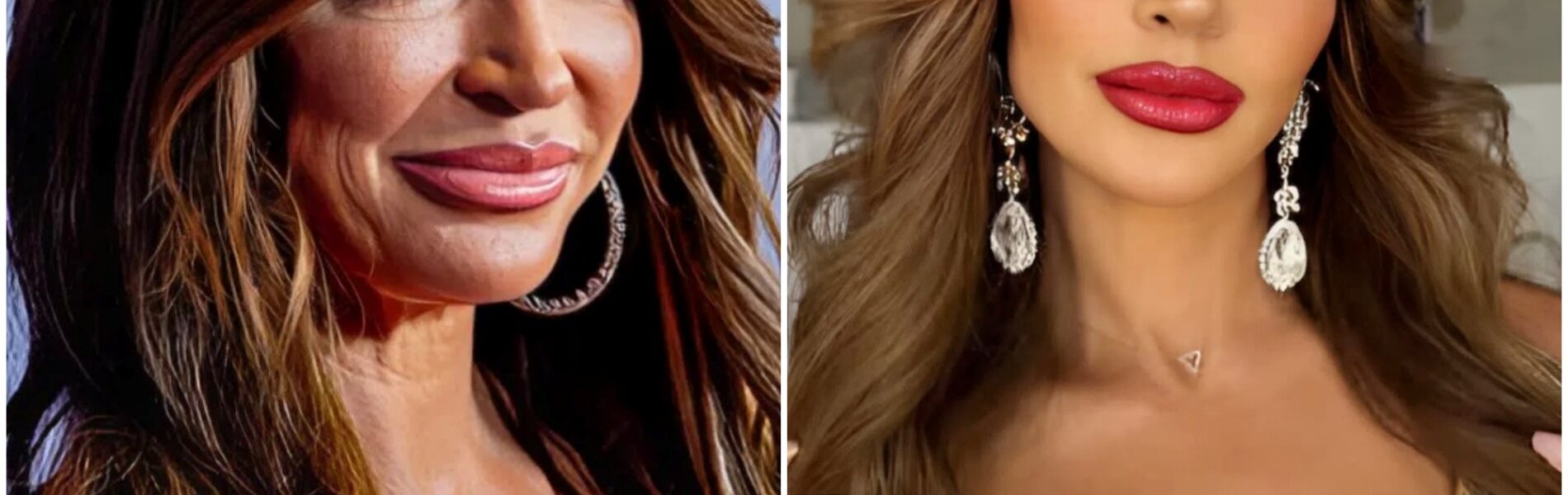 Is it fillers? Joe Giudice's ex-wife Teresa Giudice, 50, looks different on live TV — and now a Beverly Hills expert reveals what she may have had done