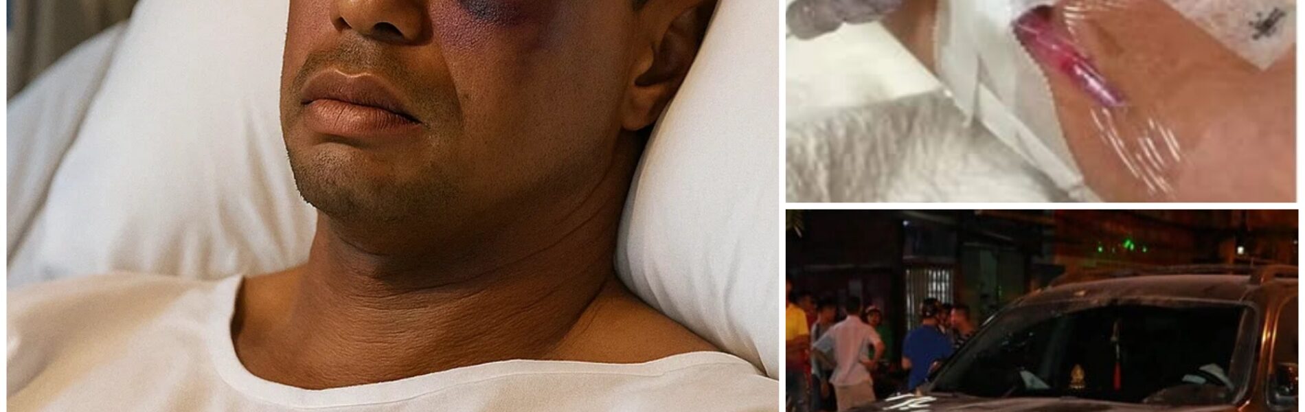 Sad News: Tiger Woods Seriously Injured Just 15 Minutes Ago — Medical Teams Rush to Stabilize Golf Legend Now in Critical Condition Following Devastating Accident…
