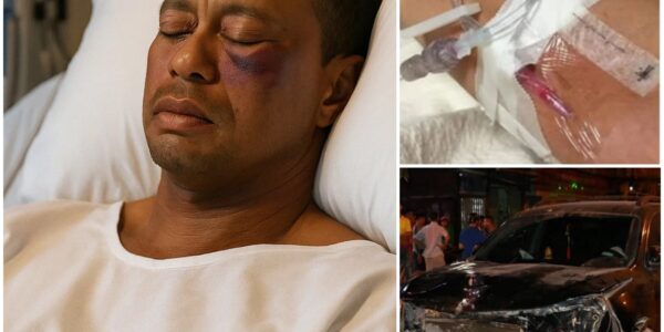Sad News: Tiger Woods Seriously Injured Just 15 Minutes Ago — Medical Teams Rush to Stabilize Golf Legend Now in Critical Condition Following Devastating Accident…