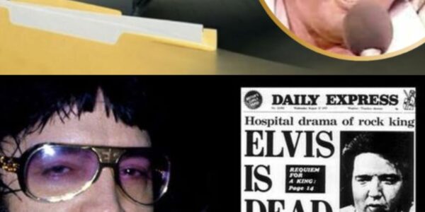 He Couldn’t Sleep, He Couldn’t Digest, and His Heart Was Twice Its Size—What Really Killed Elvis Presley?