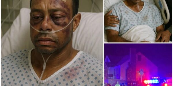 SAD NEWS: Tiger Woods Brutally Assaulted in Shocking Home Invasion — Golf Icon Battles Severe Injuries as Police Hunt for the Mysterious Attacker