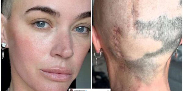 Teddi Mellencamp's battle with cancer appeared to be over — She had... given up.