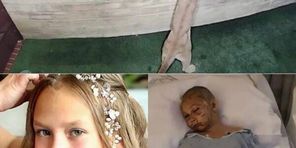 An ordinary day in Malibu turned into a nightmare when an 11-year-old girl was suddenly @tt@ck3d by a mountain lion right outside her home. Out of nowhere,...