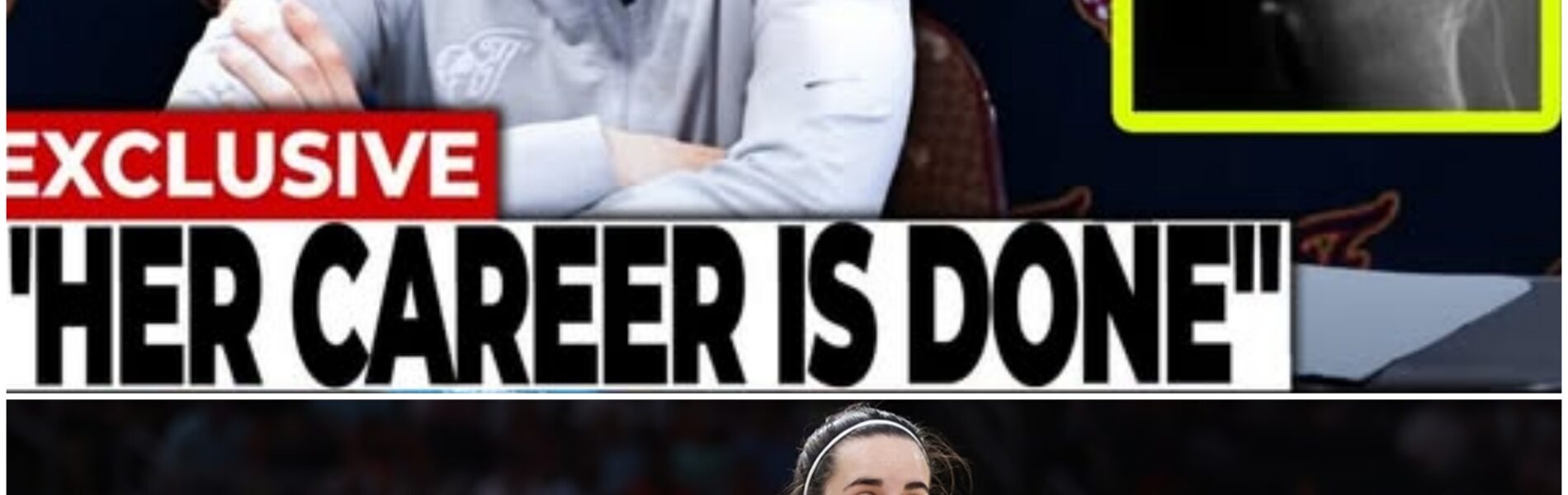 A Sickening Grin, A Brutal Takedown, And A League In Crisis: Caitlin Clark’s Injury That Shook The WNBA