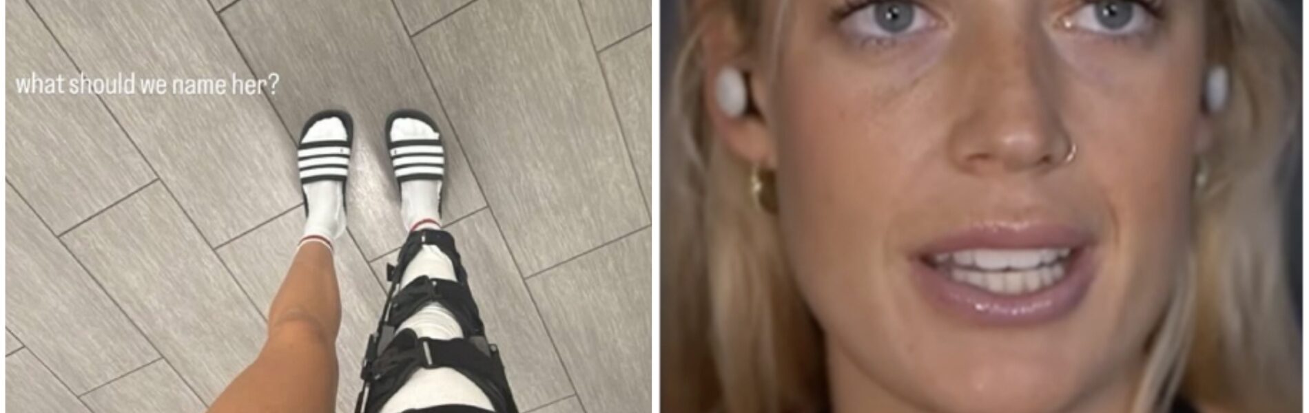 “Broken But Not Defeated: Inside a WNBA Star’s Unthinkable Comeback”