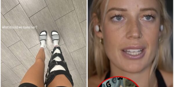 “Broken But Not Defeated: Inside a WNBA Star’s Unthinkable Comeback”