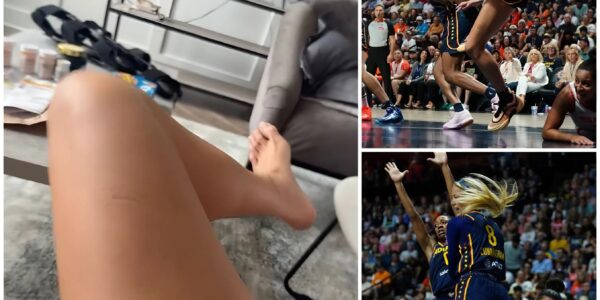 Sophie Cunningham Turns Recovery Into Comedy After Season-Ending Knee Surgery — Fans Can’t Stop Watching Her “Leg Trick” Video