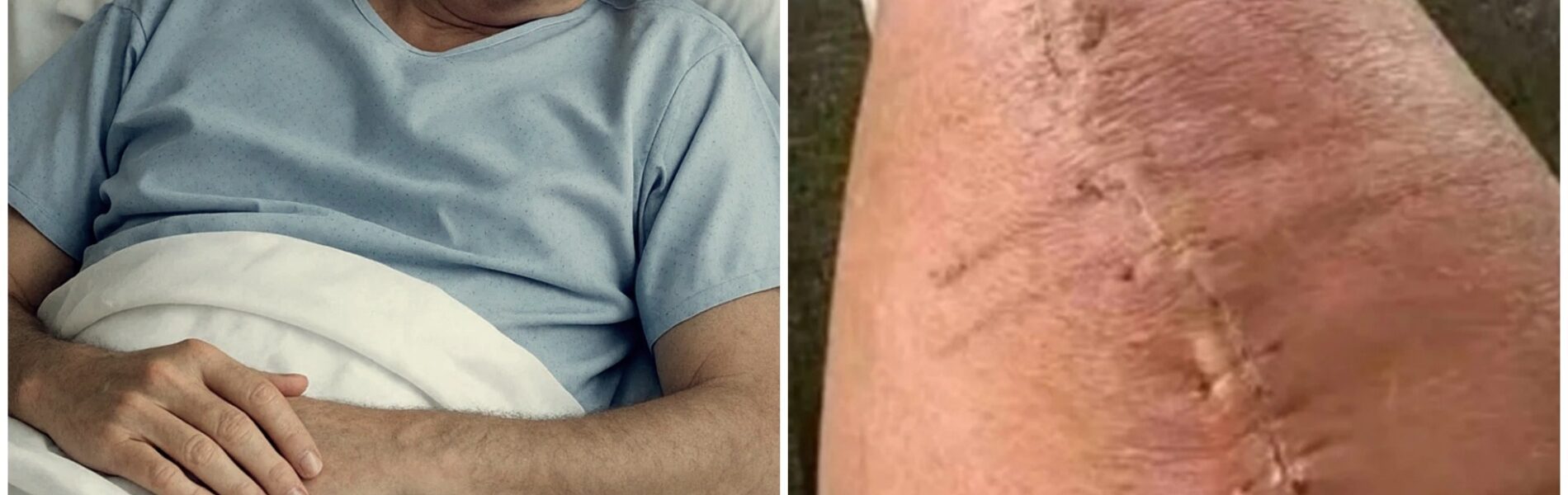 Paul McCartney Shares Emotional Message After Surgery: “I’m Fighting. But I Can’t Do It Alone.”