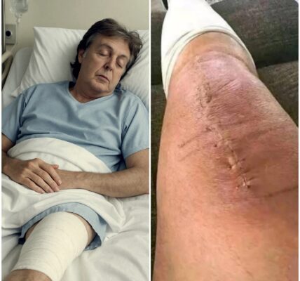 Paul McCartney Shares Emotional Message After Surgery: “I’m Fighting. But I Can’t Do It Alone.”