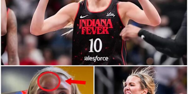 Blood, Sweat, and Swelling: How Lexie Hull’s Grit Fueled the Fever’s Fight for Playoff Survival