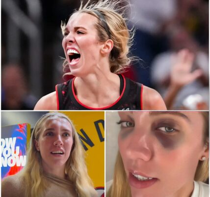 Lexie Hull Shows Incredible Resilience After Head-On Collision, Reveals Battle Scars