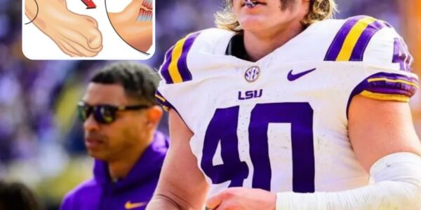 Brian Kelly Faces Lsu Fans’ Doubts After Revealing West Weeks’ Injury Status