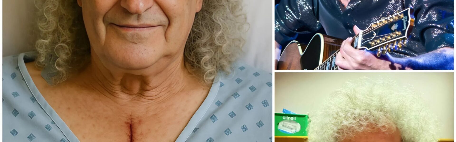 Brian May Speaks After Surgery: The Scar, the Struggle, and the Strength of a Rock Legend
