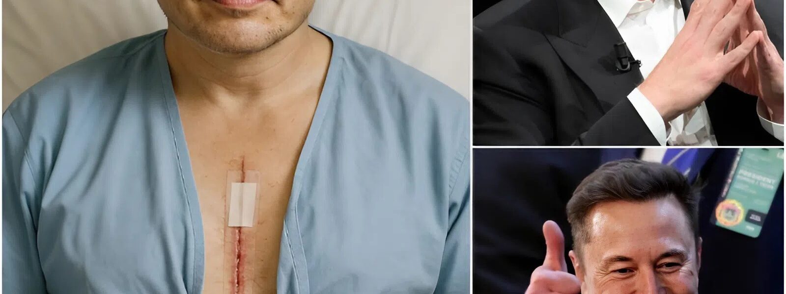 GOOD NEWS: Elon Musk breaks weeks of silence: “I am fighting. But I can’t do it alone.” After surgery, the tech titan admits vulnerability, calling recovery “a steep climb.” Fans, engineers, and even rivals flood him with support: “Stay strong, Elon. The world needs you—alive and well.” Musk’s journey of healing may turn out to be his most critical mission yet, a battle that transcends rockets, tech, and fortune.