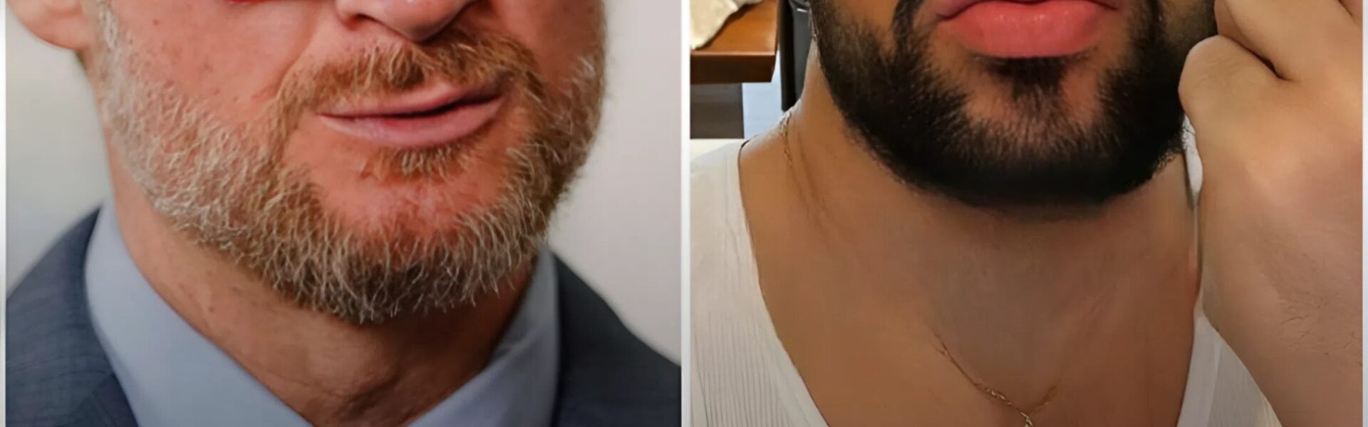 Joe Gorga Reminds America What Grace Looks Like — “I Don’t Follow Men Who Shout for a Living”