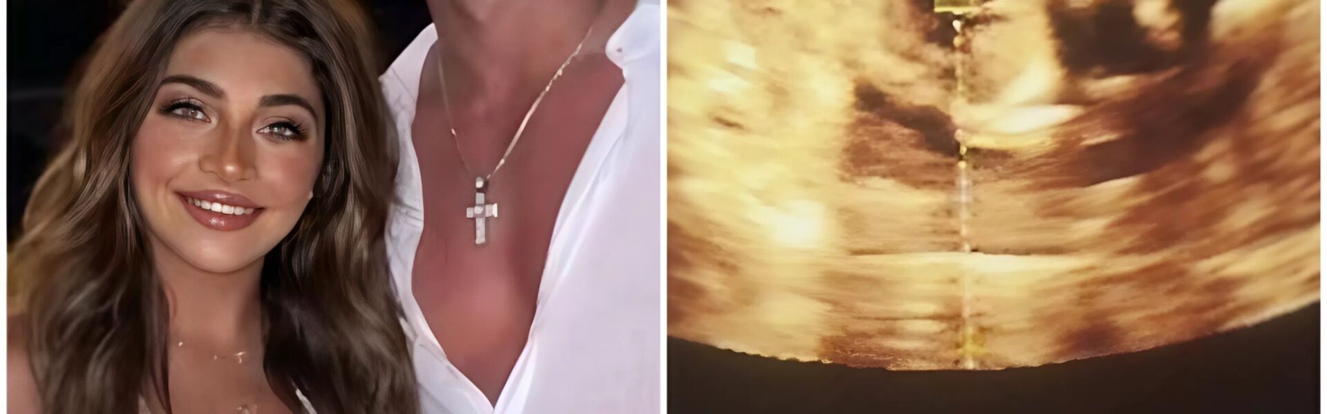 #BreakingNews Gia Giudice officially announces she's pregnant with her first child — shares sweet moments with her boyfriend in viral photo 😱