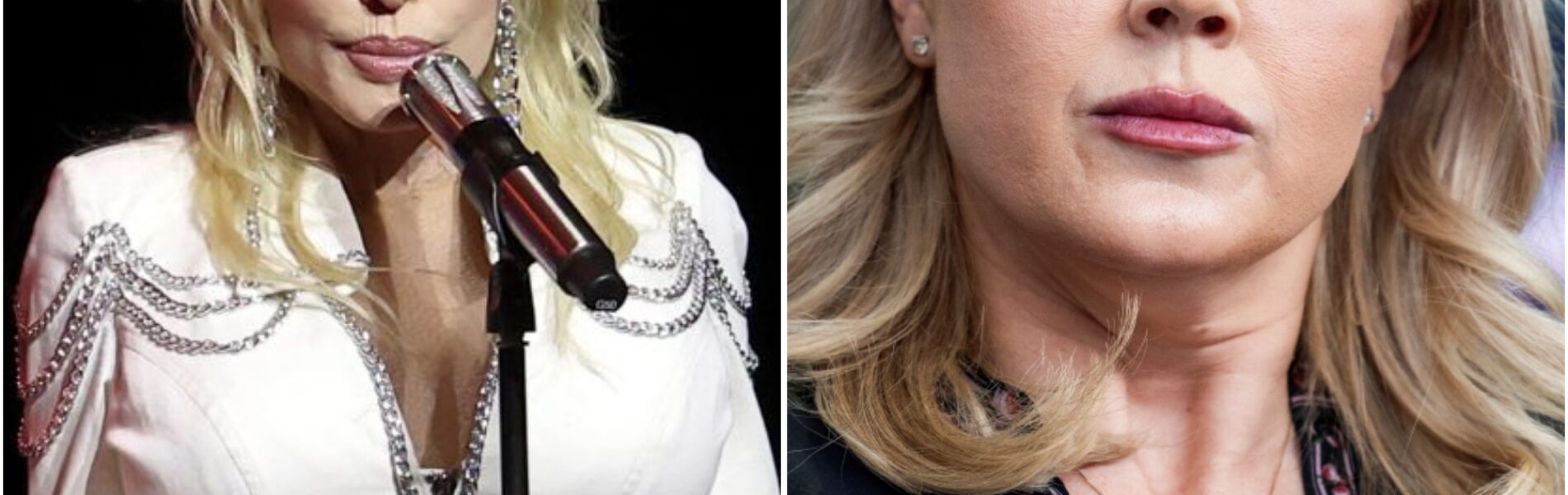 “STOP TELLING PEOPLE HOW TO LIVE!” — Dolly Parton CLAPS BACK at Karoline on Live TV, Leaving the Studio in Shock and the Nation Obsessed!!