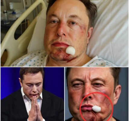 Elon Musk’s shocking fall, reportedly breaking his front teeth has sparked a storm of mystery, with insiders whispering that “something about the incident feels off.”